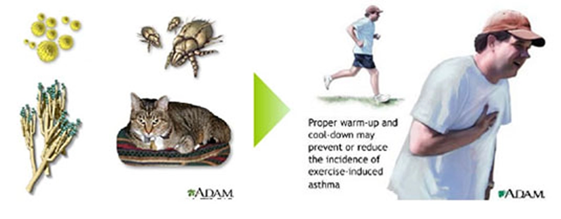 気管支喘息の特徴
